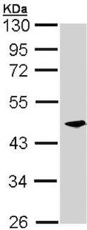 Western blot - Anti-CKMT2 antibody (AB151450), expandable thumbnail