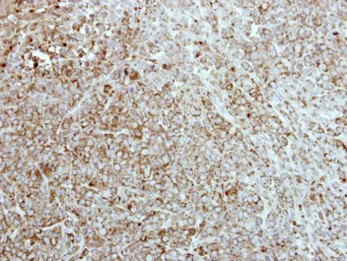 Immunohistochemistry (Formalin/PFA-fixed paraffin-embedded sections) - Anti-CKMT2 antibody (AB227440)