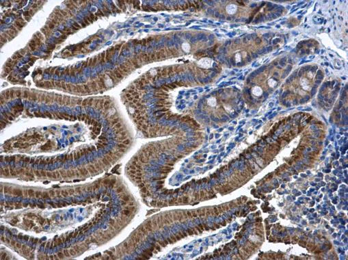 Immunohistochemistry (Formalin/PFA-fixed paraffin-embedded sections) - Anti-CKMT2 antibody (AB227440)