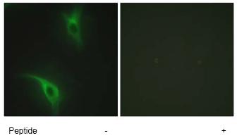 Immunocytochemistry/ Immunofluorescence - Anti-CKS1 antibody (AB72639)