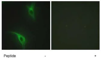 Immunocytochemistry/ Immunofluorescence - Anti-CKS1 antibody (AB72639)