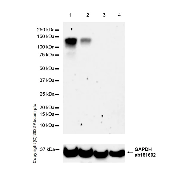 Western blot - Anti-CLACP antibody [EPR24205-82] - BSA and Azide free (AB307539)