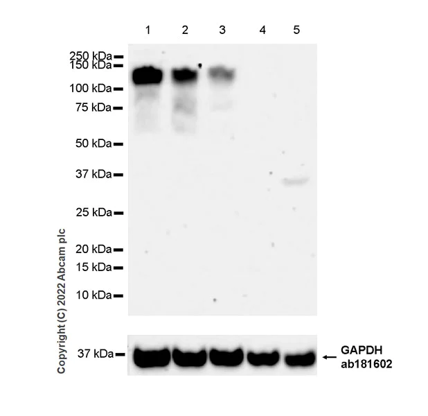 Western blot - Anti-CLACP antibody [EPR24205-82] - BSA and Azide free (AB307539)