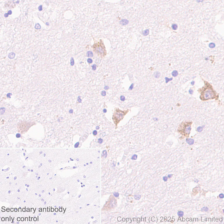 Immunohistochemistry (Formalin/PFA-fixed paraffin-embedded sections) - Anti-CLACP antibody [EPR30286-530] (AB324634)