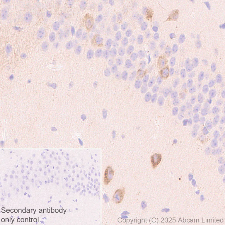 Immunohistochemistry (Formalin/PFA-fixed paraffin-embedded sections) - Anti-CLACP antibody [EPR30286-530] (AB324634)