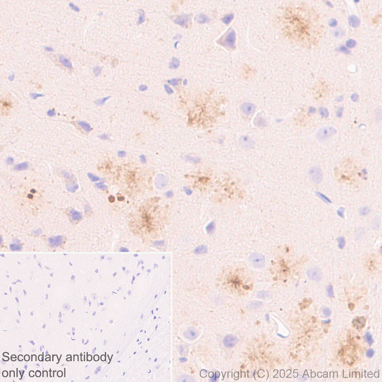 Immunohistochemistry (Formalin/PFA-fixed paraffin-embedded sections) - Anti-CLACP antibody [EPR30286-530] (AB324634)