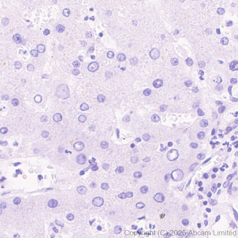 Immunohistochemistry (Formalin/PFA-fixed paraffin-embedded sections) - Anti-CLACP antibody [EPR30286-530] (AB324634)