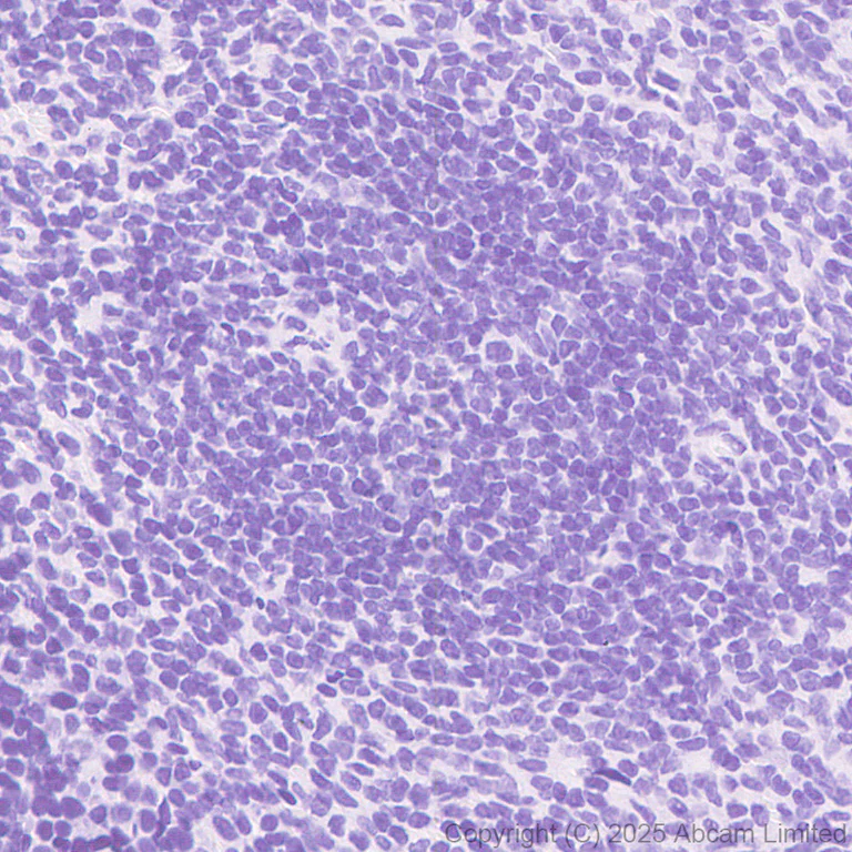Immunohistochemistry (Formalin/PFA-fixed paraffin-embedded sections) - Anti-CLACP antibody [EPR30286-530] (AB324634)