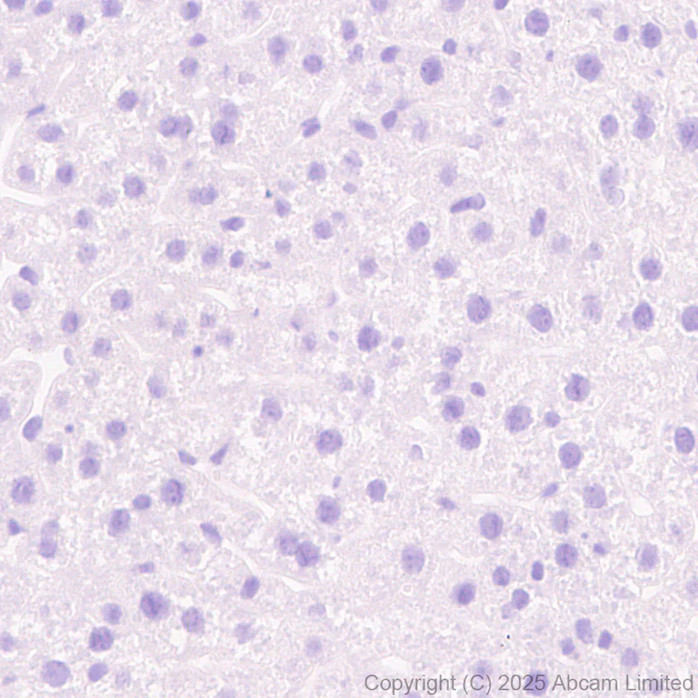 Immunohistochemistry (Formalin/PFA-fixed paraffin-embedded sections) - Anti-CLACP antibody [EPR30286-530] (AB324634)