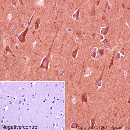 Immunohistochemistry (Formalin/PFA-fixed paraffin-embedded sections) - Anti-CLASP1 antibody [EPR3409] (AB108620)