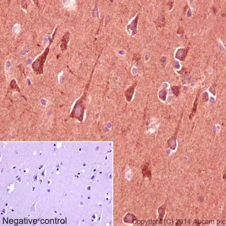 Immunohistochemistry (Formalin/PFA-fixed paraffin-embedded sections) - Anti-CLASP1 antibody [EPR3409] (AB108620)