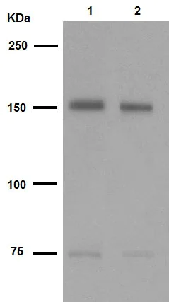 Western blot - Anti-CLASP1 antibody [EPR3409] (AB108620)