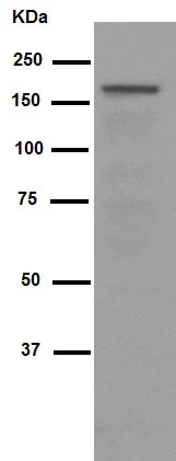 Western blot - Anti-CLASP1 antibody [EPR3409] (AB108620)