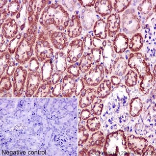 Immunohistochemistry (Formalin/PFA-fixed paraffin-embedded sections) - Anti-CLASP1 antibody [EPR3409] - BSA and Azide free (ab232576), expandable thumbnail