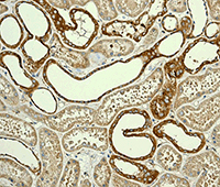 Immunohistochemistry (Formalin/PFA-fixed paraffin-embedded sections) - Anti-CLASP1 antibody [EPR3409] - BSA and Azide free (AB232576), expandable thumbnail