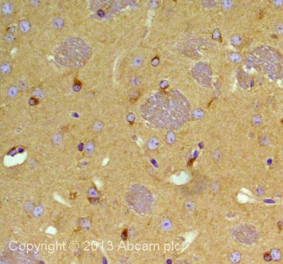 Immunohistochemistry (Formalin/PFA-fixed paraffin-embedded sections) - Anti-CLASP2 antibody [KT68] (AB95373)