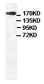 Western blot - Anti-Claspin antibody (AB94945)