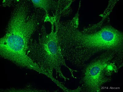 Immunocytochemistry/ Immunofluorescence - Anti-Clathrin heavy chain antibody (AB21679)