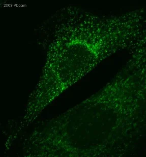 Immunocytochemistry/ Immunofluorescence - Anti-Clathrin heavy chain antibody (AB21679)