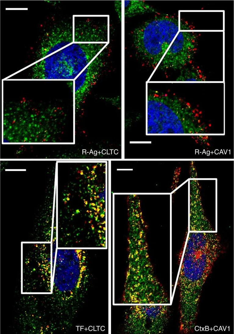 Immunocytochemistry/ Immunofluorescence - Anti-Clathrin heavy chain antibody (AB21679)