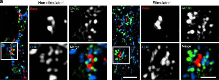 Immunocytochemistry/ Immunofluorescence - Anti-Clathrin heavy chain antibody (AB21679)