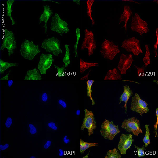 Anti-Clathrin heavy chain antibody (ab21679) | Abcam