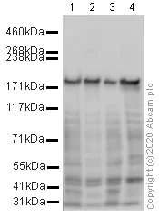 Western blot - Anti-Clathrin heavy chain antibody (AB21679)