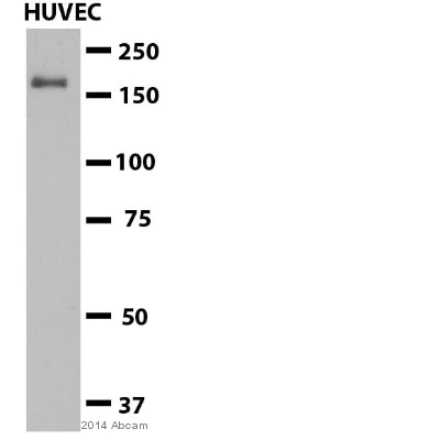 Western blot - Anti-Clathrin heavy chain antibody (AB21679)