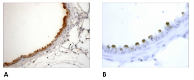Immunohistochemistry (Formalin/PFA-fixed paraffin-embedded sections) - Anti-Clathrin heavy chain antibody (AB59710), expandable thumbnail