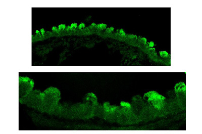 Immunohistochemistry (Formalin/PFA-fixed paraffin-embedded sections) - Anti-Clathrin heavy chain antibody (AB59710), expandable thumbnail