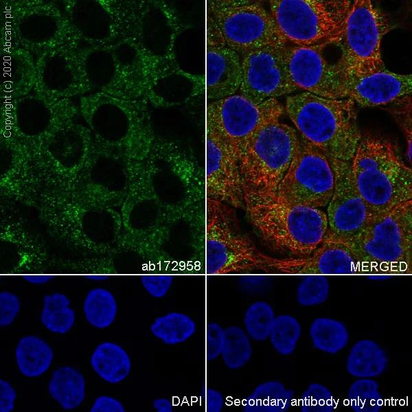 Immunocytochemistry/ Immunofluorescence - Anti-Clathrin heavy chain antibody [EPR12235(B)] (AB172958)