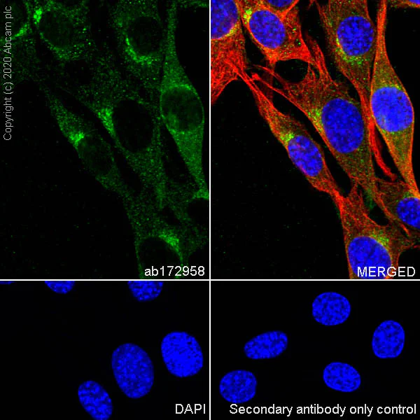 Immunocytochemistry/ Immunofluorescence - Anti-Clathrin heavy chain antibody [EPR12235(B)] (AB172958)