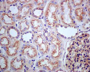Immunohistochemistry (Formalin/PFA-fixed paraffin-embedded sections) - Anti-Clathrin heavy chain antibody [EPR12235(B)] (AB172958)