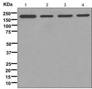 Western blot - Anti-Clathrin heavy chain antibody [EPR12235(B)] (AB172958)