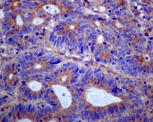 Immunohistochemistry (Formalin/PFA-fixed paraffin-embedded sections) - Anti-Clathrin heavy chain antibody [EPR12235(B)] - BSA and Azide free (AB240172), expandable thumbnail