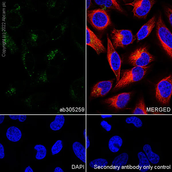 Immunocytochemistry/ Immunofluorescence - Anti-Clathrin heavy chain antibody [EPR24236-222] (AB305259)
