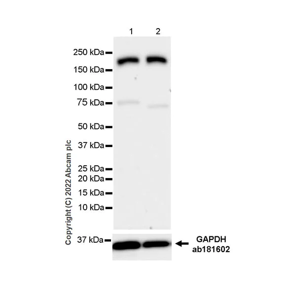 Western blot - Anti-Clathrin heavy chain antibody [EPR24236-222] - BSA and Azide free (AB305260)