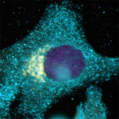 Immunocytochemistry/ Immunofluorescence - Anti-Clathrin heavy chain antibody [TD.1] (AB24578), expandable thumbnail