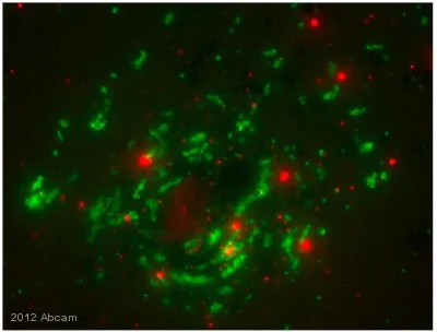 Immunocytochemistry/ Immunofluorescence - Anti-Clathrin heavy chain antibody [X22] (AB2731)