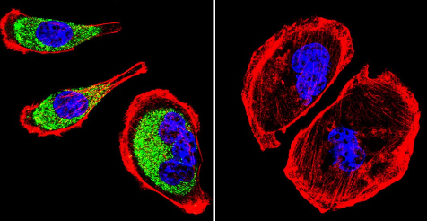 Immunocytochemistry/ Immunofluorescence - Anti-Clathrin heavy chain antibody [X22] (AB2731)