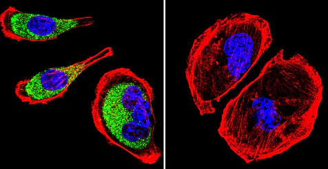 Immunocytochemistry/ Immunofluorescence - Anti-Clathrin heavy chain antibody [X22] (AB2731)