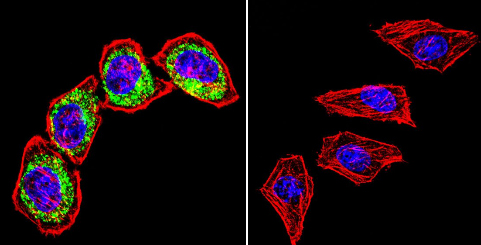 Anti-Clathrin heavy chain antibody [X22] (ab2731) | Abcam