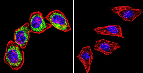 Anti-Clathrin heavy chain antibody [X22] (ab2731) | Abcam