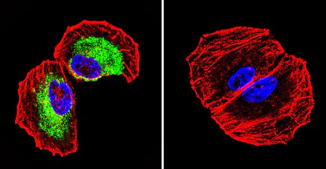 Immunocytochemistry/ Immunofluorescence - Anti-Clathrin heavy chain antibody [X22] (AB2731)