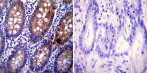 Immunohistochemistry (Formalin/PFA-fixed paraffin-embedded sections) - Anti-Clathrin heavy chain antibody [X22] (AB2731)