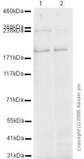 Western blot - Anti-Clathrin heavy chain antibody [X22] (AB2731)