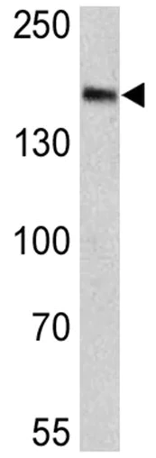 Western blot - Anti-Clathrin heavy chain antibody [X22] (AB2731)