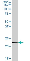 Western blot - Anti-Clathrin light chain antibody (AB103553)