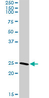 Western blot - Anti-Clathrin light chain antibody (AB103553), expandable thumbnail