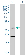 Western blot - Anti-Clathrin light chain antibody (AB103553)
